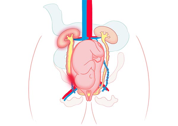 medical illustration designed by artmedstudio.com