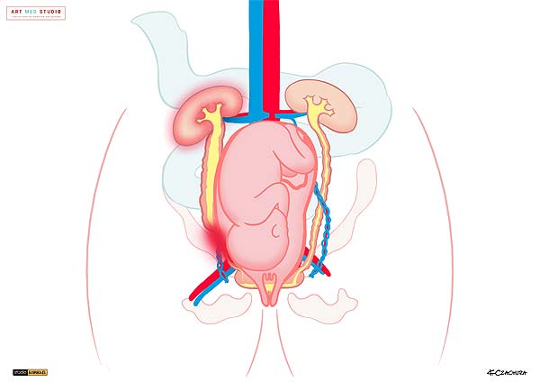 medical illustration designed by artmedstudio.com