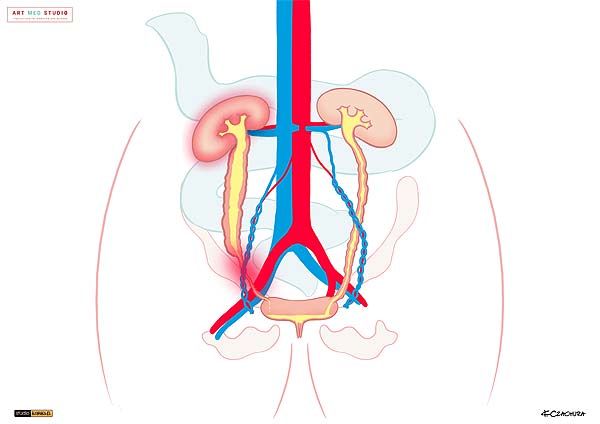 medical illustration designed by artmedstudio.com