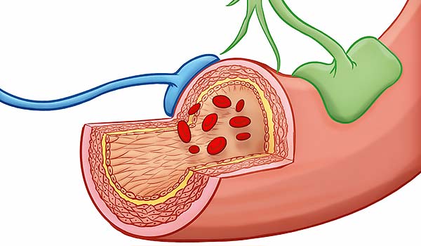 medical illustration designed by artmedstudio.com