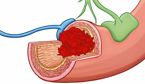 medical illustration designed by artmedstudio.com