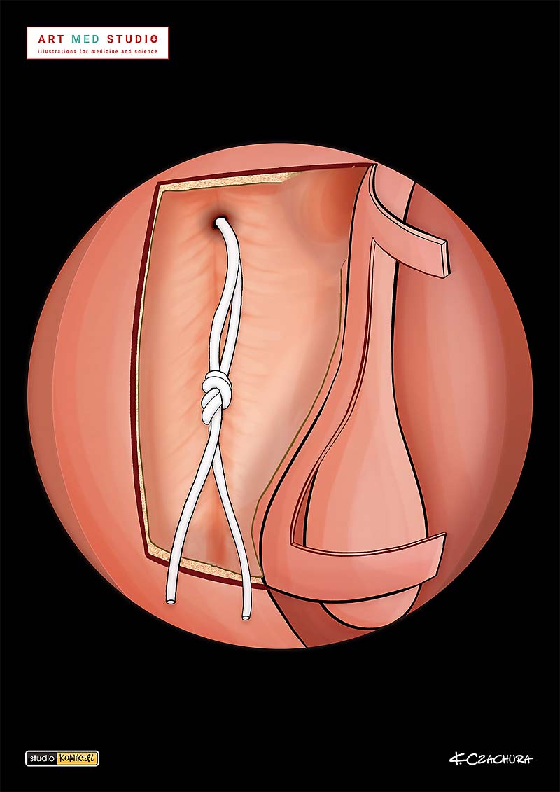 medical illustration designed by artmedstudio.com