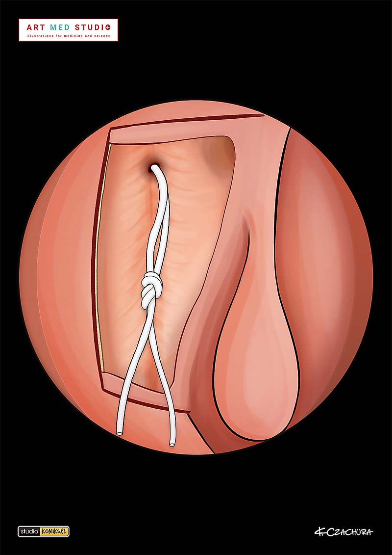 medical illustration designed by artmedstudio.com