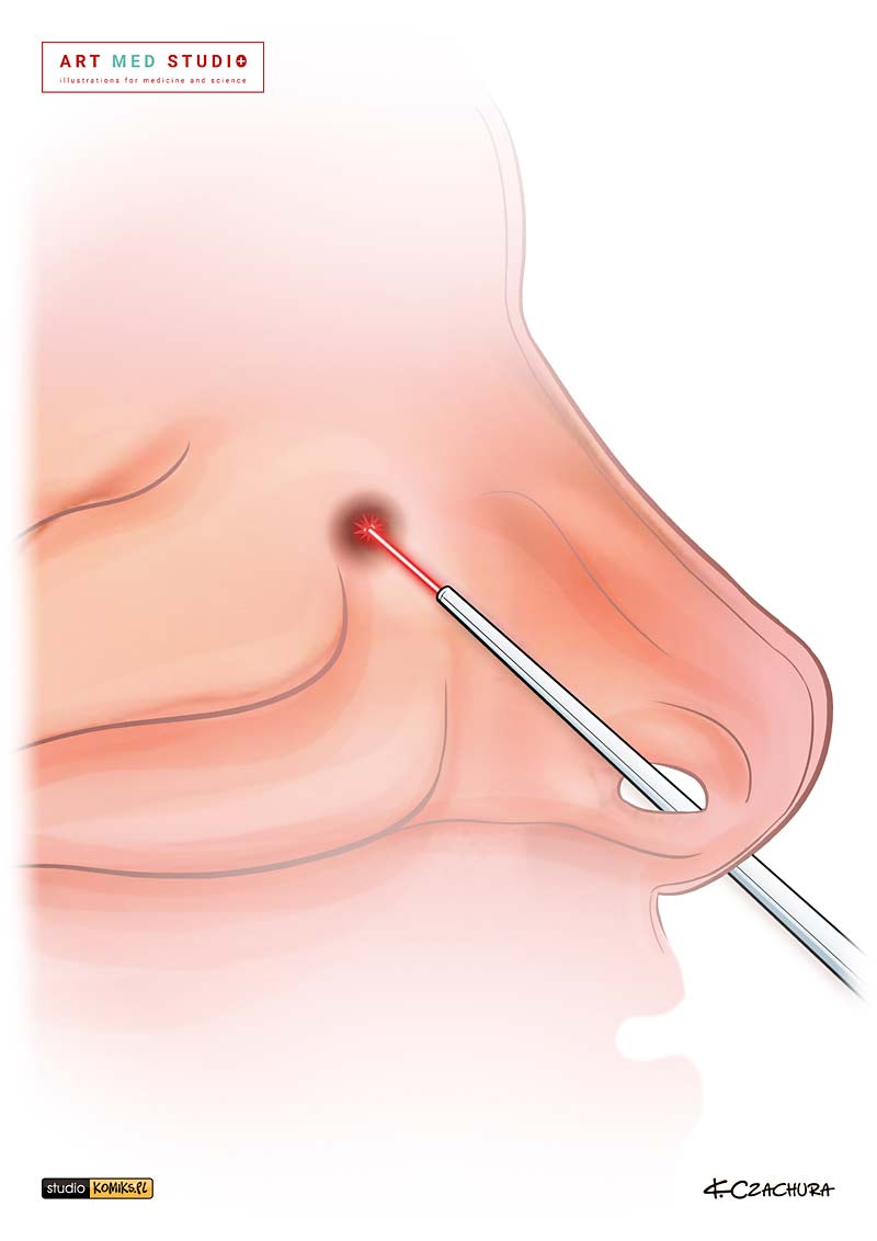 medical illustration designed by artmedstudio.com