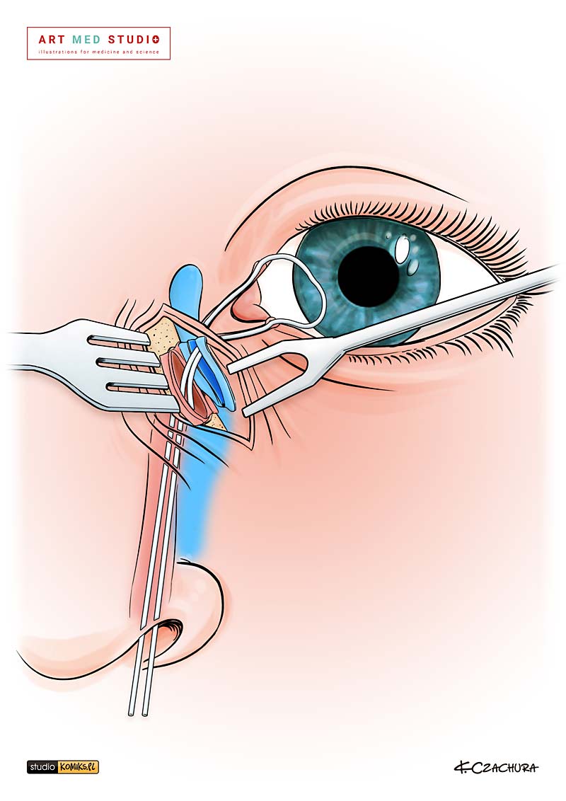 medical illustration designed by artmedstudio.com