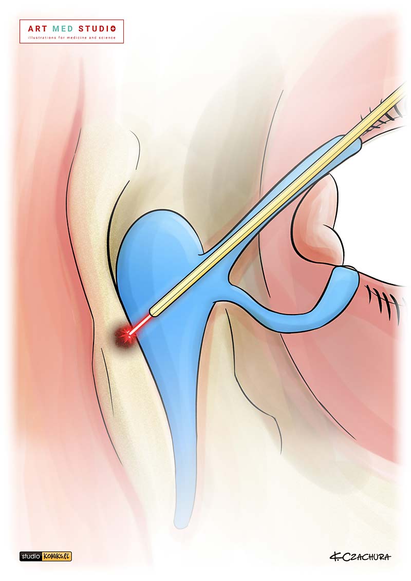 medical illustration designed by artmedstudio.com