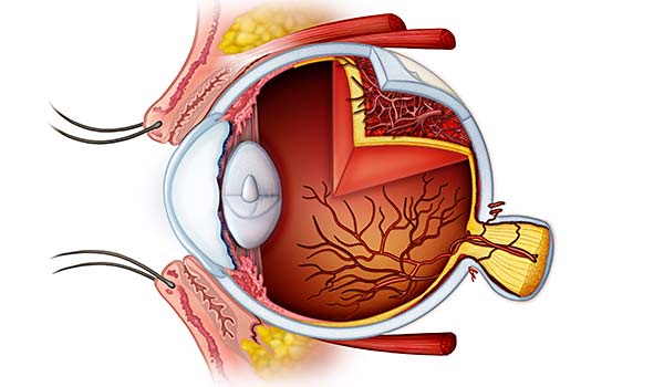 medical illustration designed by artmedstudio.com