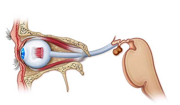 medical illustration designed by artmedstudio.com