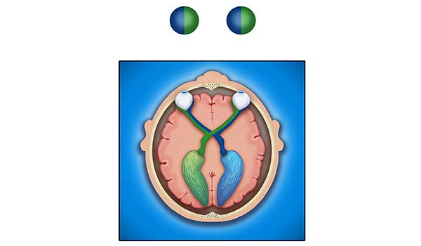 medical illustration designed by artmedstudio.com