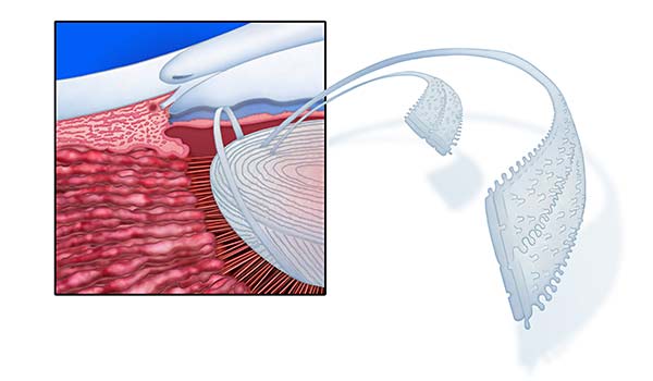 medical illustration designed by artmedstudio.com