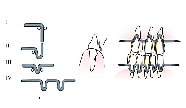 medical illustration designed by artmedstudio.com