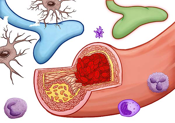 medical illustration designed by artmedstudio.com