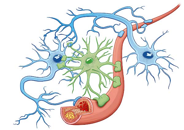 medical illustration designed by artmedstudio.com