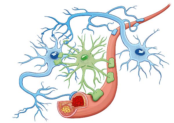 medical illustration designed by artmedstudio.com