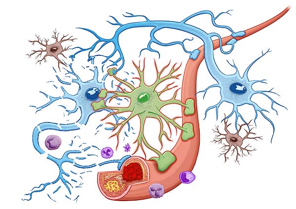 medical illustration designed by artmedstudio.com