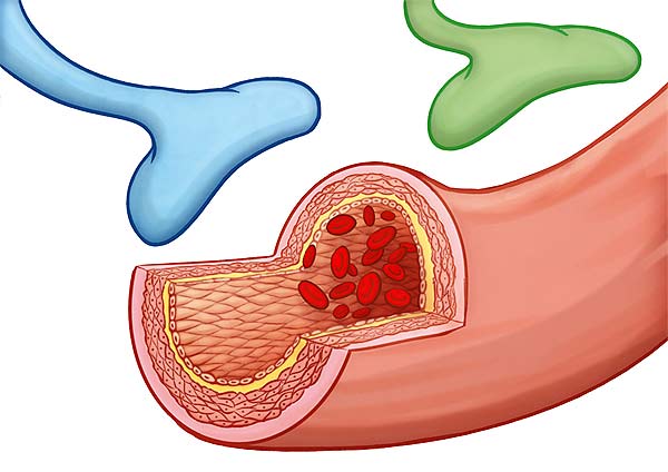 medical illustration designed by artmedstudio.com