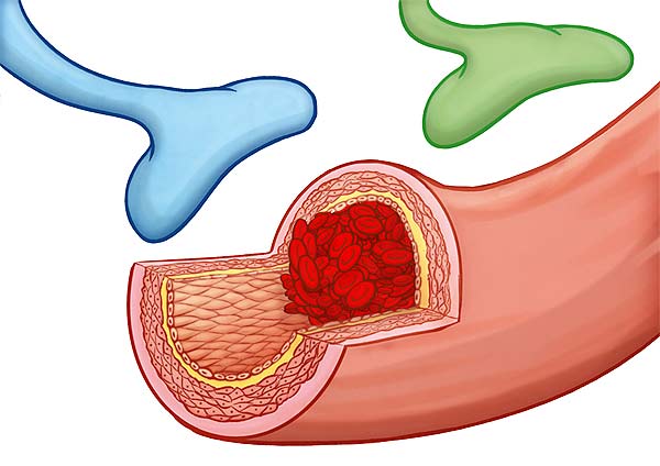 medical illustration designed by artmedstudio.com