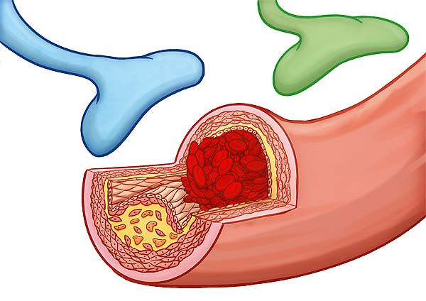 medical illustration designed by artmedstudio.com