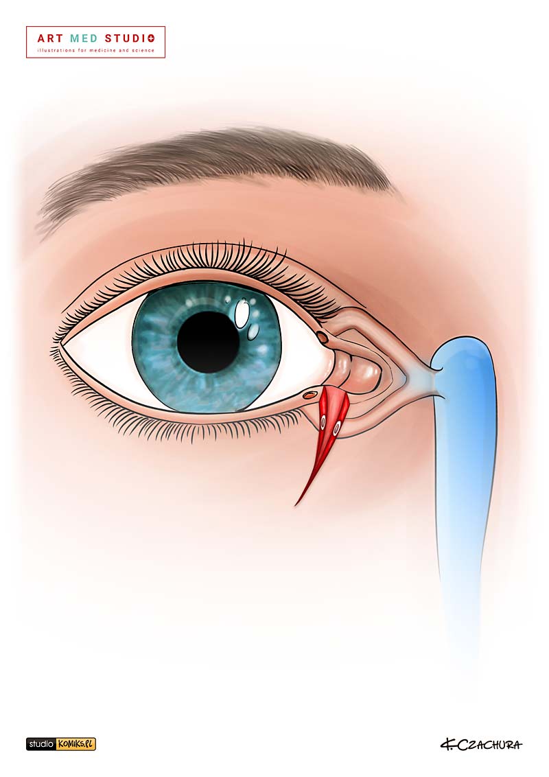 medical illustration designed by artmedstudio.com