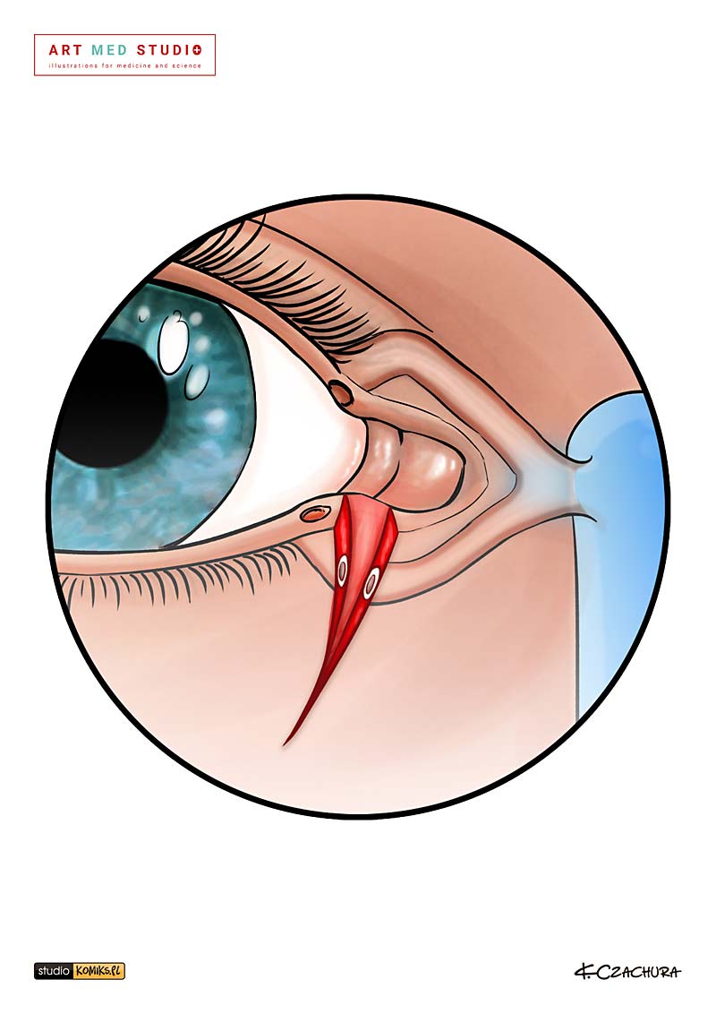 medical illustration designed by artmedstudio.com