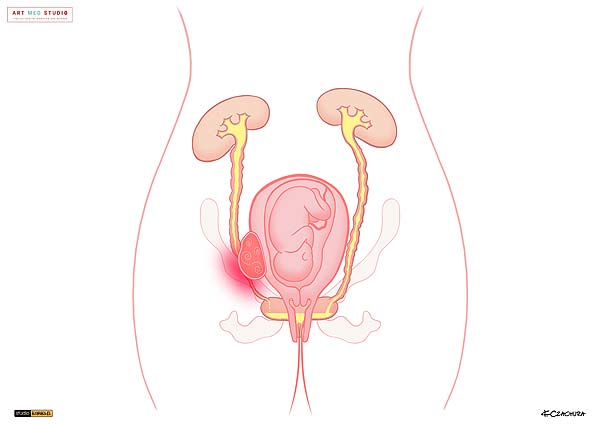 medical illustration designed by artmedstudio.com