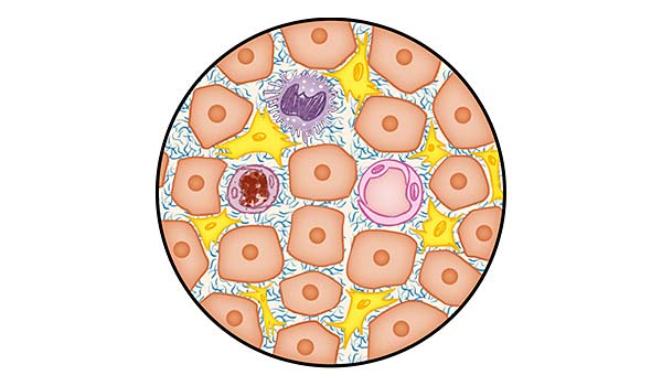 medical illustration designed by artmedstudio.com