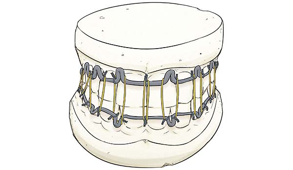 medical illustration designed by artmedstudio.com