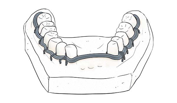 medical illustration designed by artmedstudio.com