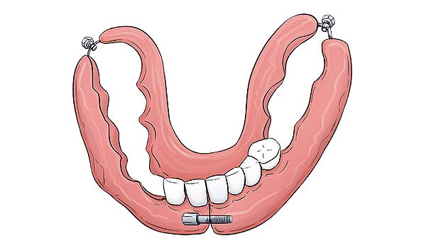 medical illustration designed by artmedstudio.com